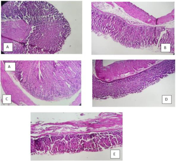 Evaluation of the prevention, treatment and synergistic activity between <i>Helicobacter pylori</i> IgY antibodies and pantaprazole on AGS cell line and C57BL/6 Mice.