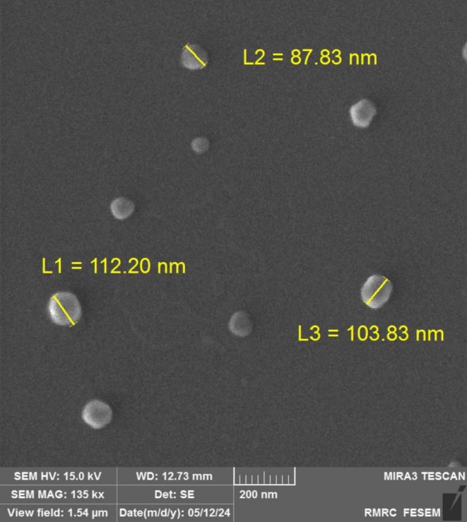 A Double-Blind Randomised Clinical Trial of Terbinafine-Nanostructured Lipid Carriers: Should We Anticipate This Strategy for Effective Topical Treatment of Onychomycosis?