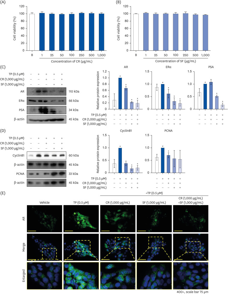 The combination of water extracts of <i>Curcumae</i> Radix and <i>Syzygii</i> Flos improves benign prostatic hyperplasia by suppressing testosterone-induced proliferation of prostate cells <i>in vivo</i> and <i>in vitro</i>.