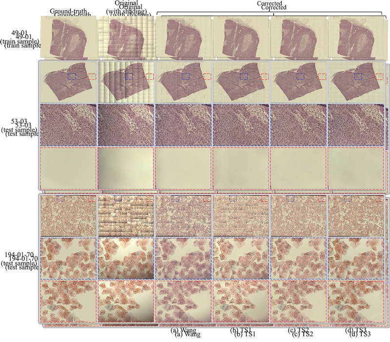 Training Set Design for Uneven Illumination Correction in High-Resolution Whole Slide Images.