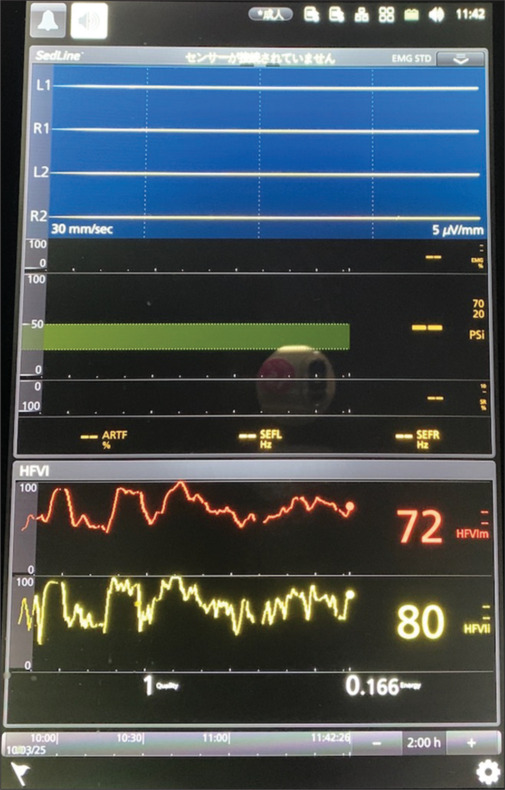 Recording rates of high-frequency variability index monitoring and use of vasoactive medications in daily clinical practice: A prospective observational study.