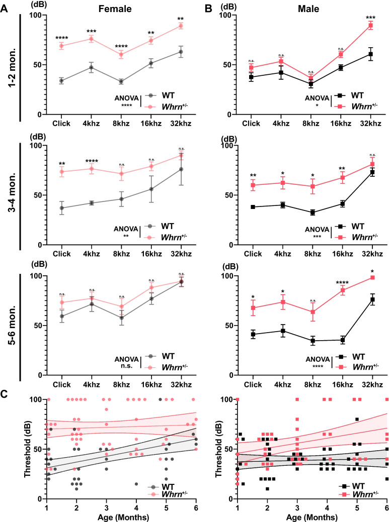Haploinsufficiency of Whrn Contributes to Progressive Sensorineural Hearing Loss in C57BL6 Mice.