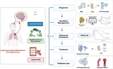 Chinese Expert Consensus on Leptomeningeal Metastases of Lung Cancer.