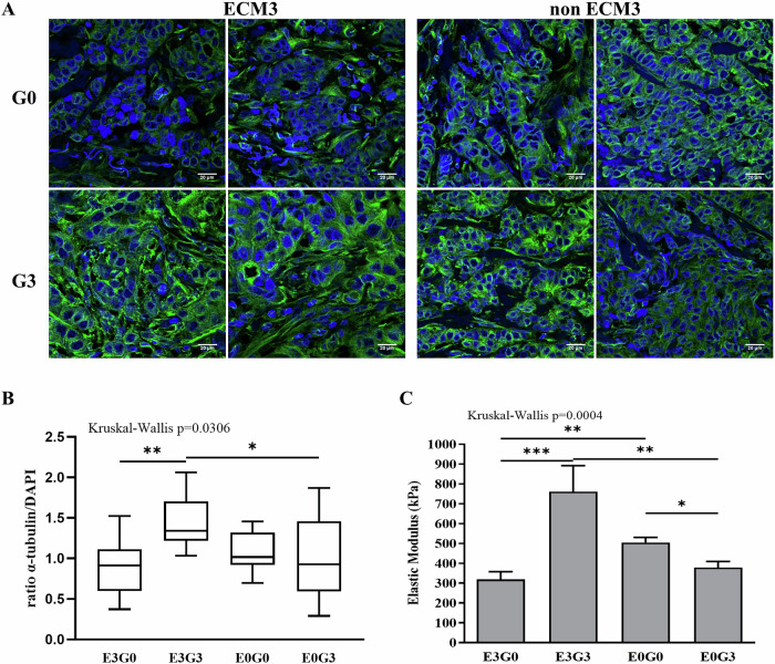 Proteomic landscape of decellularized breast carcinomas identifies C-type lectin domain family 3 member A as a driver of cancer aggressiveness.