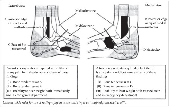 Knowledge-Based Expert System for Orthopedic Injury Management With Integrated Transcutaneous Electrical Nerve Simulation Therapy.