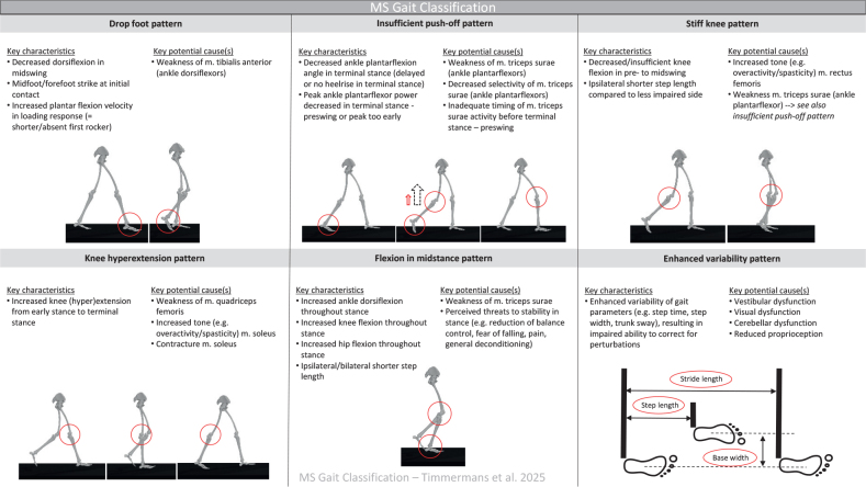 A Delphi study to identify key gait patterns and their potential causes in people with multiple sclerosis.