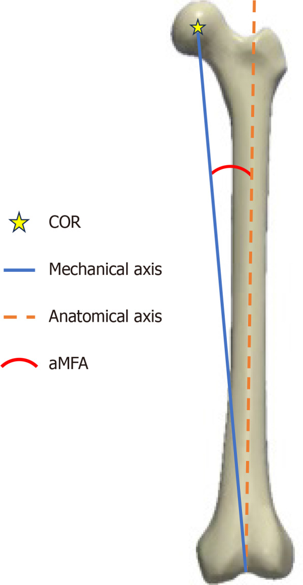 Pure high-offset stems can cause an unexpected increase in femoral length in robotic-assisted primary total hip arthroplasty.
