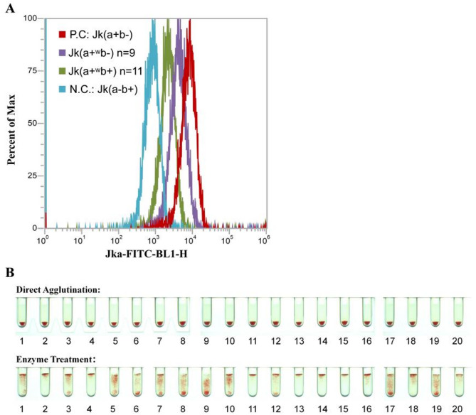 Promoter polymorphisms in the JK*01 W.06 allele associated with the Jk(a + <sup>w</sup>) weak antigen phenotype.