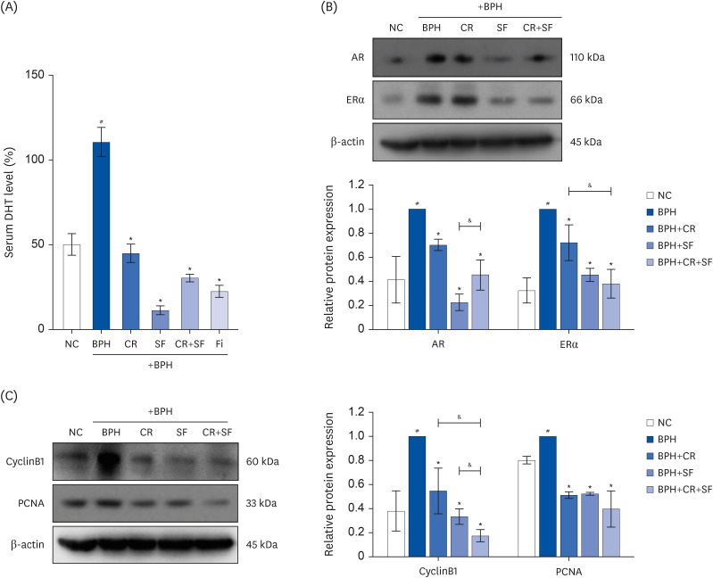 The combination of water extracts of <i>Curcumae</i> Radix and <i>Syzygii</i> Flos improves benign prostatic hyperplasia by suppressing testosterone-induced proliferation of prostate cells <i>in vivo</i> and <i>in vitro</i>.