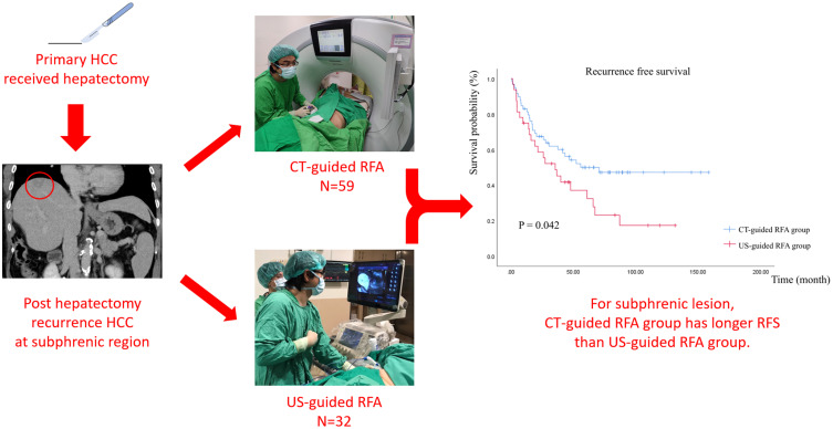 Comparison of Computed Tomography and Ultrasound-Guided Radiofrequency Ablation for Recurrent Subdiaphragmatic Hepatocellular Carcinoma After Resection.