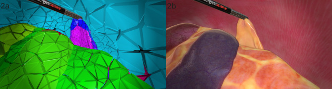 The development of a novel virtual reality simulation module for canine laparoscopic ovariectomy.