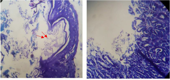 Evaluation of the prevention, treatment and synergistic activity between <i>Helicobacter pylori</i> IgY antibodies and pantaprazole on AGS cell line and C57BL/6 Mice.
