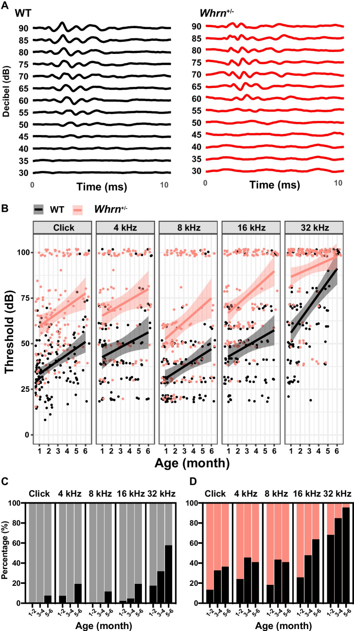 Haploinsufficiency of Whrn Contributes to Progressive Sensorineural Hearing Loss in C57BL6 Mice.