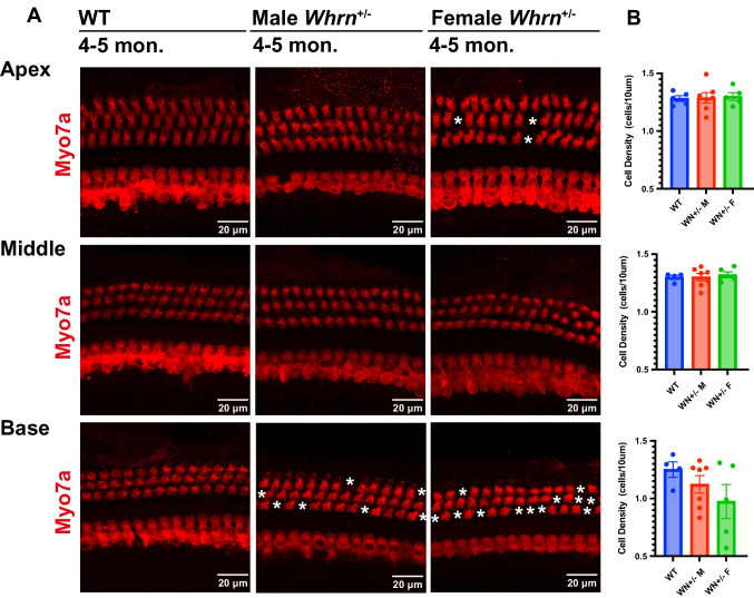Haploinsufficiency of Whrn Contributes to Progressive Sensorineural Hearing Loss in C57BL6 Mice.