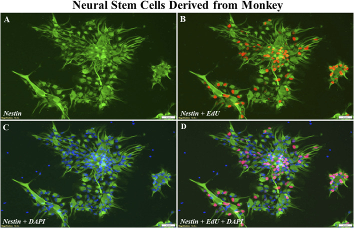 Assessing potential desflurane-induced neurotoxicity using nonhuman primate neural stem cell models.