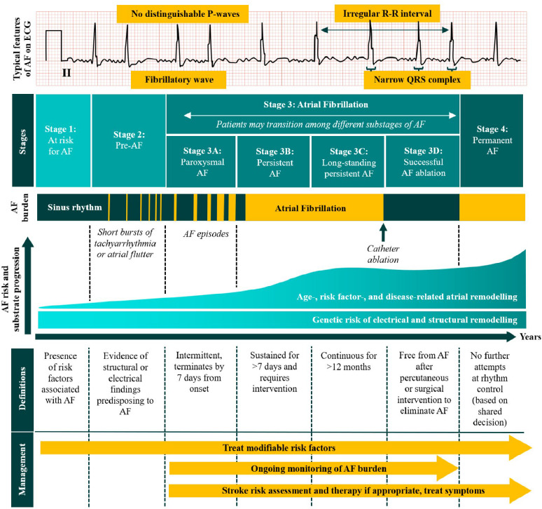 A comparative review of current international atrial fibrillation guidelines from a primary care perspective.