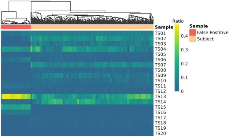 Monitoring the rate and variability of somatic genomic alterations using long-read sequencing.