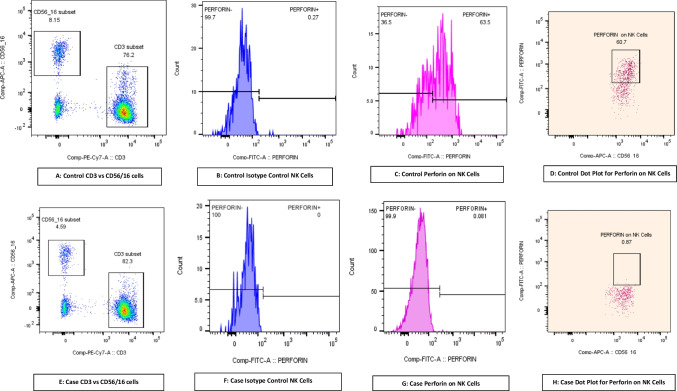 Clinicopathological and Immunogenetic Characterization in 8 Patients with Familial Hemophagocytic Lymphohistiocytosis Type 2: A Study from North India with Literature Review.