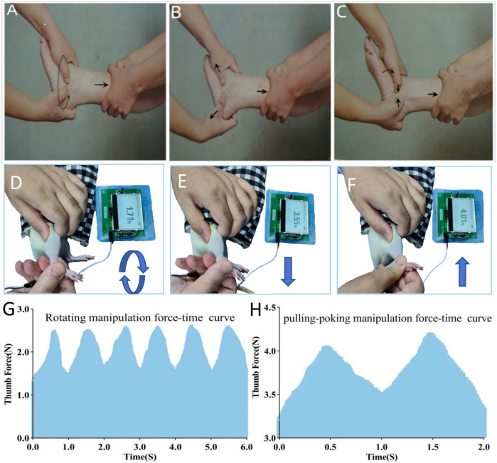 Rotating-pulling-poking manipulation effectively alleviates pain symptoms of lateral ankle sprain: an animal experimental study.