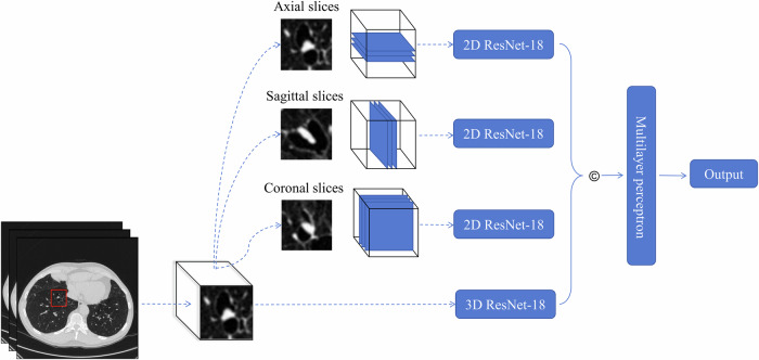 A multi-view CNN model to predict resolving of new lung nodules on follow-up low-dose chest CT.