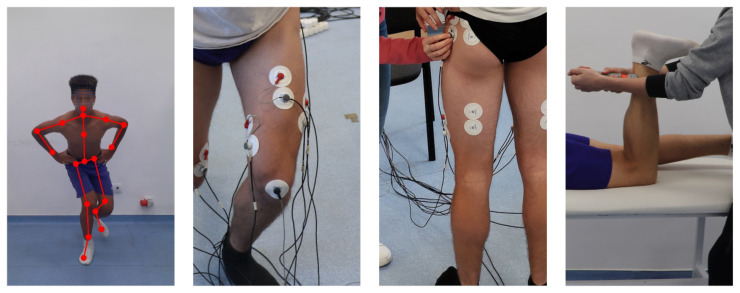The Effect of Functional Training on Dynamic Knee Valgus of Youth Soccer Players: A Pilot Study.
