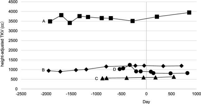 Renoprotective effects of combination therapy with tolvaptan and dapagliflozin in autosomal dominant polycystic kidney disease: a four-case series.