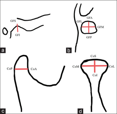 Assessment of condylar and glenoid fossa dimension in various sagittal skeletal malocclusions.