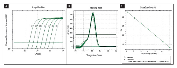 Detection of Streptococcus pneumoniae in sterile liquids using real-time PCR (qPCR) in hospitalized patients with suspected invasive pneumococcal disease.