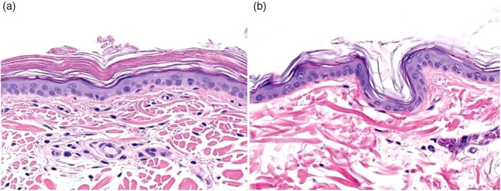 Intragenic PNPLA1 duplication in Labrador retrievers with nonepidermolytic ichthyosis.
