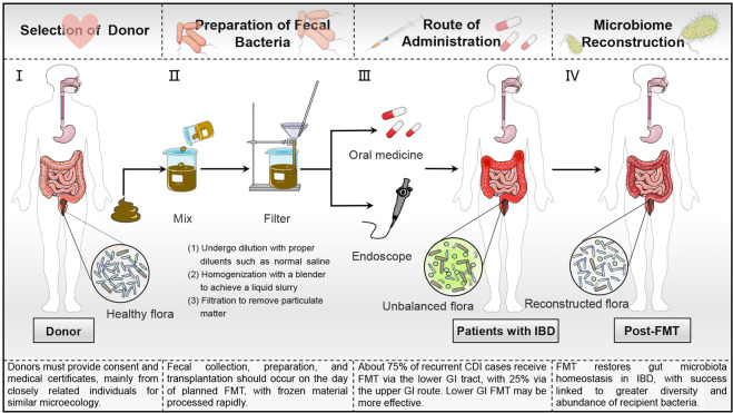 The current landscape of fecal microbiota transplantation in treating inflammatory bowel disease.