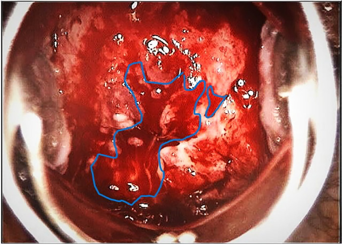 What is your diagnosis?