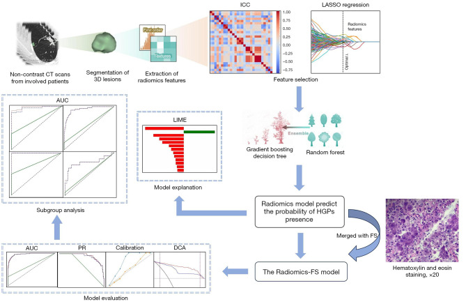 Enhancing the intraoperative identification of high-grade patterns in invasive lung adenocarcinoma via radiomics.