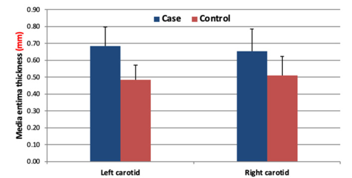 Pulmonary function test and carotid intima-media thickness in chronic obstructive pulmonary disease.
