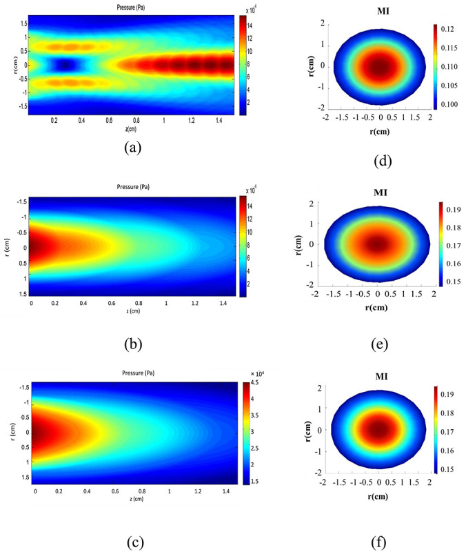 Ultrasound Waves Effect on the Proliferation of Fibroblast Cells: Collagen Type I Expression.