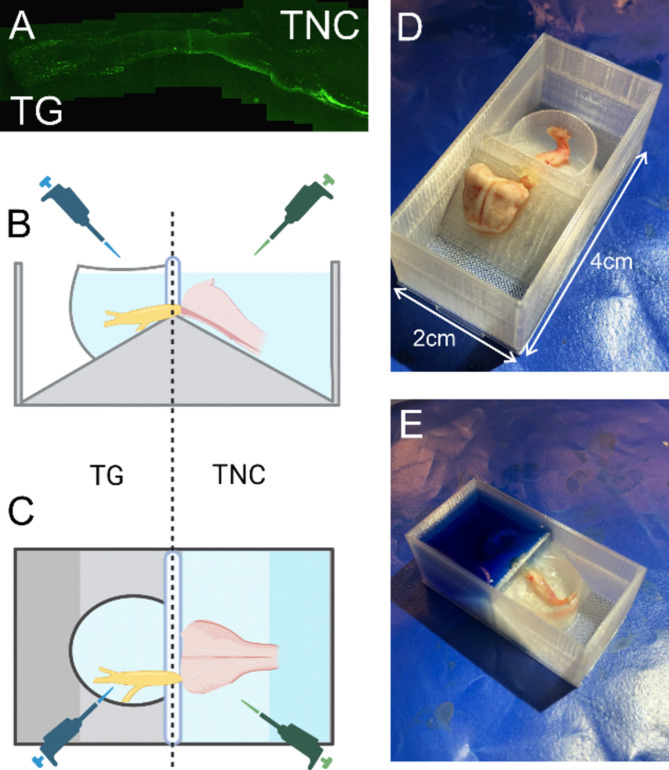 Ex vivo stimulation of the trigeminal nucleus caudalis induces peripheral CGRP release in the trigeminal ganglion and reveals a distinct dopamine-endocannabinoid mechanism relevant to migraine.