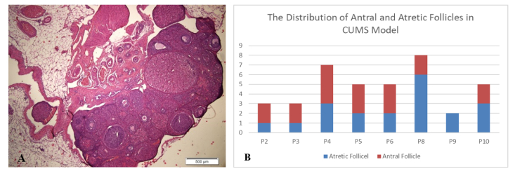 How does chronic unpredictable mild stress affect the number of mature oocytes? An experimental study.