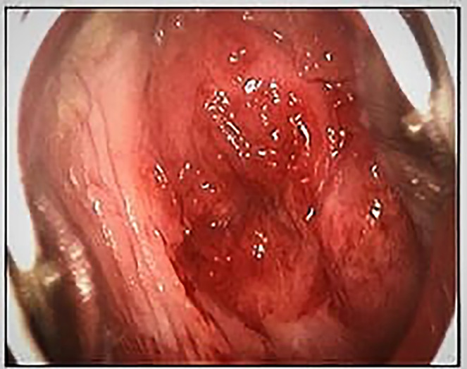 What is your diagnosis?