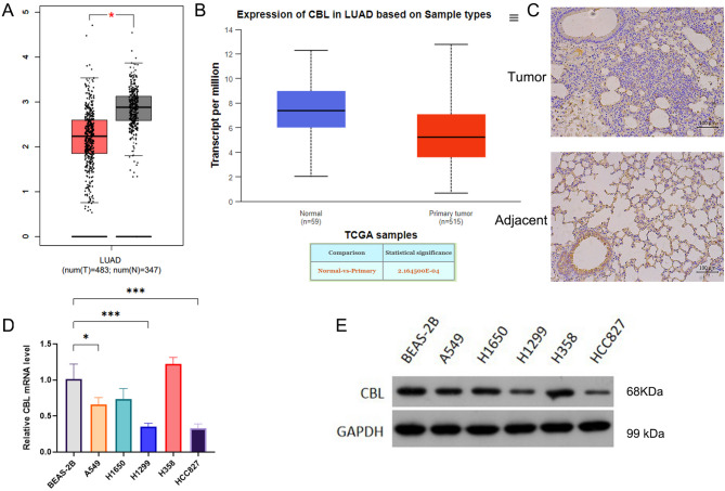 E3 ubiquitin-protein ligase CBL inhibits non-small cell lung cancer progression via ubiquitination and degradation of KDR.