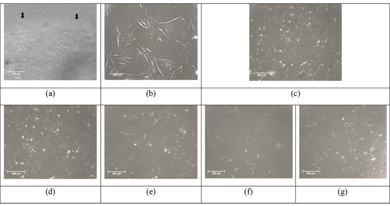 Ultrasound Waves Effect on the Proliferation of Fibroblast Cells: Collagen Type I Expression.