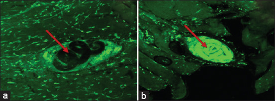 Viability of <i>Trichinella spiralis</i> in traditional sour pork fermentation and its inactivation by microwave heating: Implications for zoonotic risk and food safety.