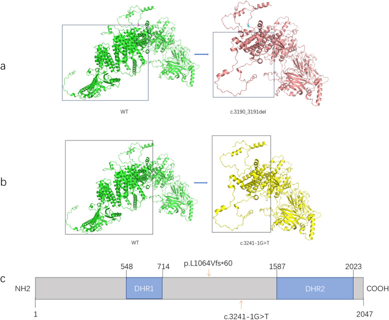 Novel compound heterozygous DOCK6 variants expand the mutational spectrum in prenatal diagnosis of Adams-Oliver syndrome 2.