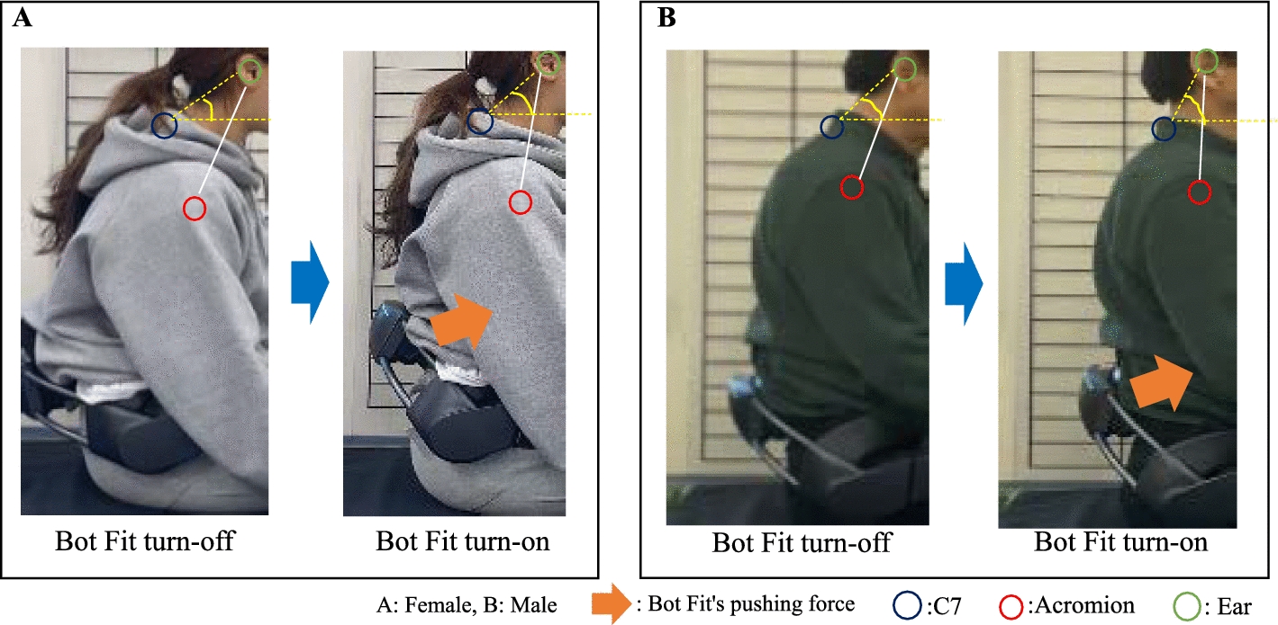 Effects of the lumbar support function of wearable robot (Bot Fit) on sitting position.