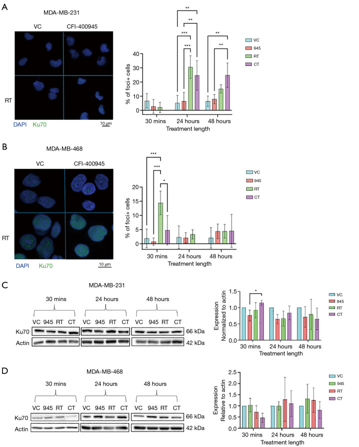 Investigation of effects of CFI-400945 and ionizing radiation on DNA damage response in triple-negative breast cancer.
