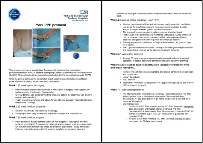 A structured protocol for Preoperative Progressive Pneumoperitoneum (PPP) in Complex Abdominal Wall Reconstruction (CAWR): our York protocol.