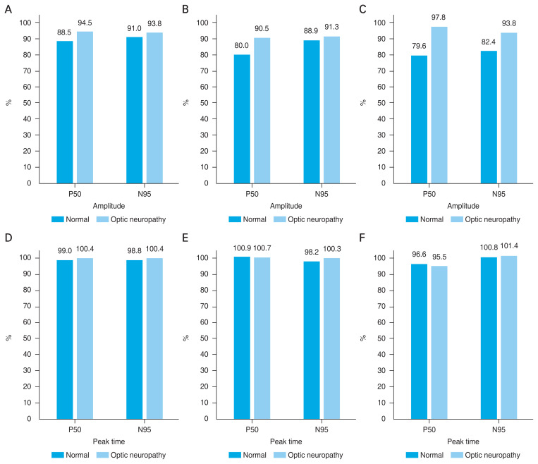 Effect of 50-Hz Filters on Pattern Electroretinogram.