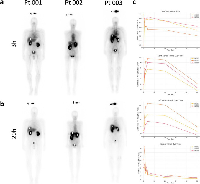Imaging Cell Surface Plectin in PDAC Patients - A First-In-Human Phase 0 Study Report.
