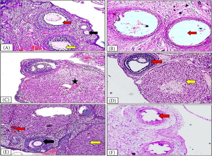 Antioxidant and cytokine modulation in PCOS rats protected with probiotics, myo-inositol, and herbal extracts.
