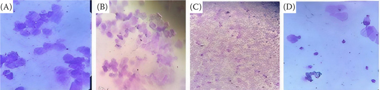 Antioxidant and cytokine modulation in PCOS rats protected with probiotics, myo-inositol, and herbal extracts.