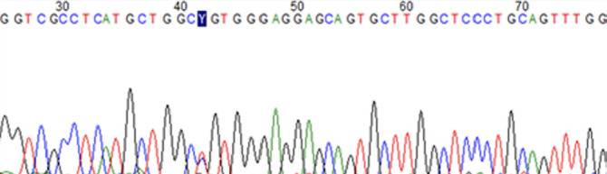 The Effect of GLUT-1-XbaI G>T and HaeIII T>C Polymorphisms on <sup>18</sup>F-FDG Uptake Rates.