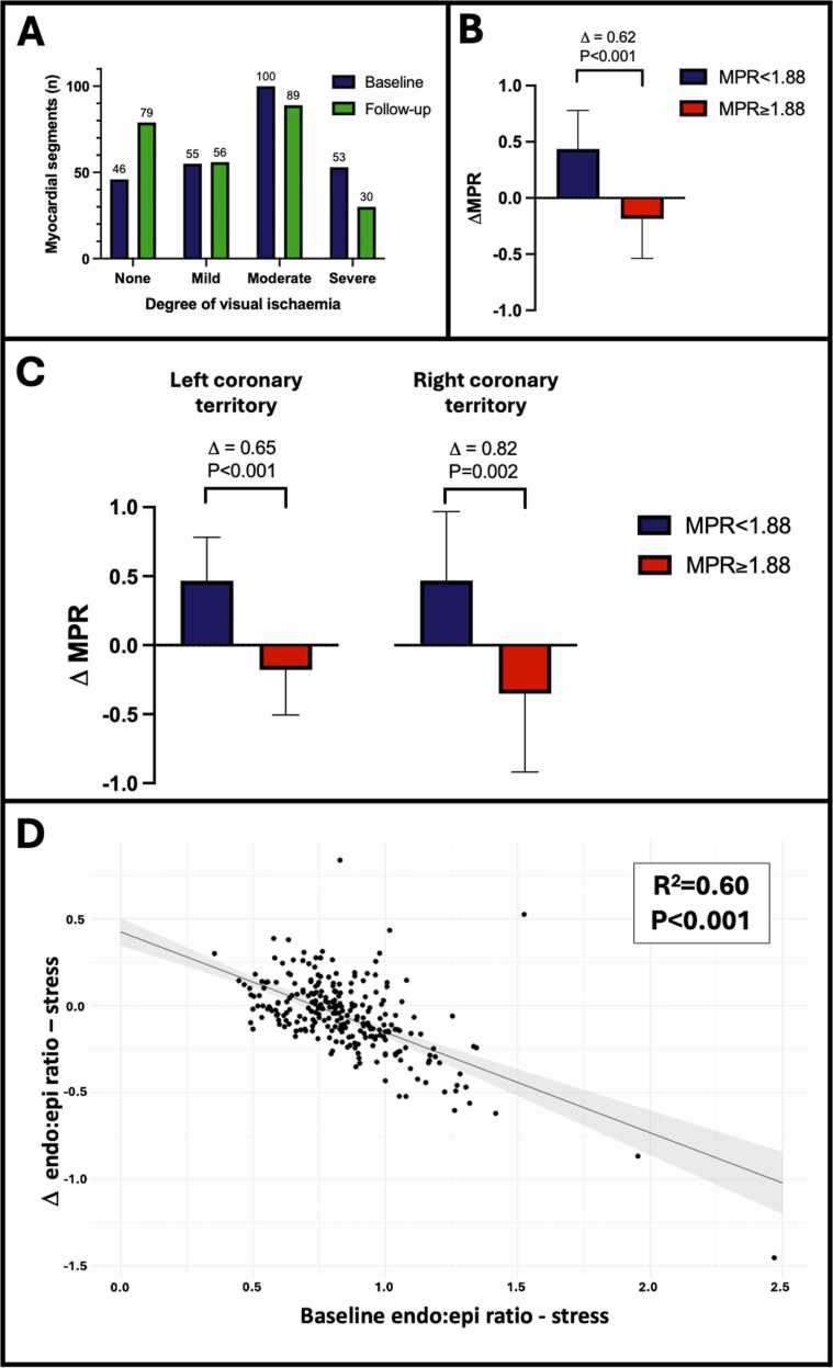 Segmental redistribution of myocardial blood flow after coronary sinus reducer implantation demonstrated by quantitative perfusion cardiovascular magnetic resonance.